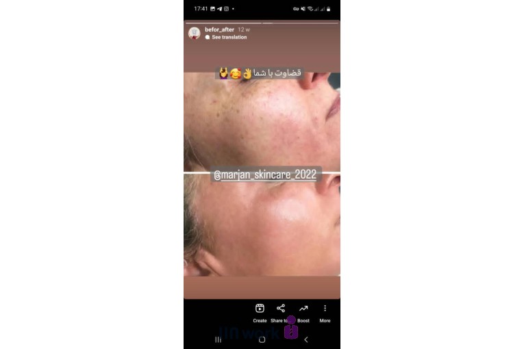 فیشیال و پاکسازی پوست مرجان پرهیزی در شیراز