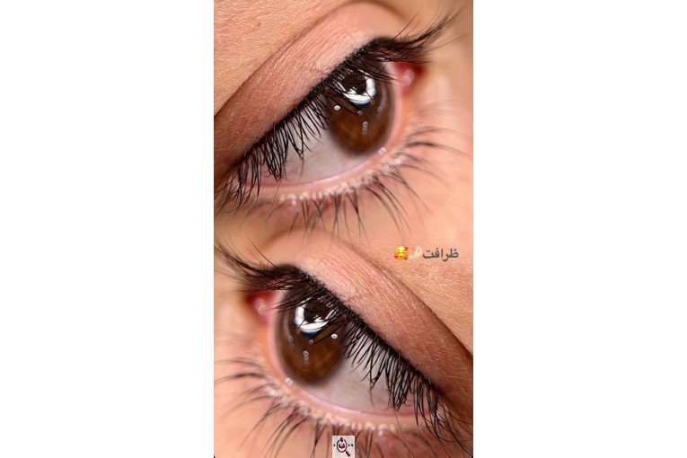 میکرویبلیدینگ تخصصی فیبروز و بولد بروز مریم دیلم در علی آباد گلستان