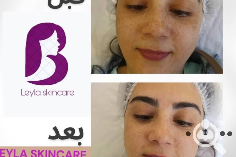 بهترین خدمات فیشیال پوست در اصفهان