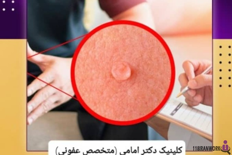 کلینیک زیبایی و درمان قطعی زگیل تناسلی دکتر امامی در شیراز