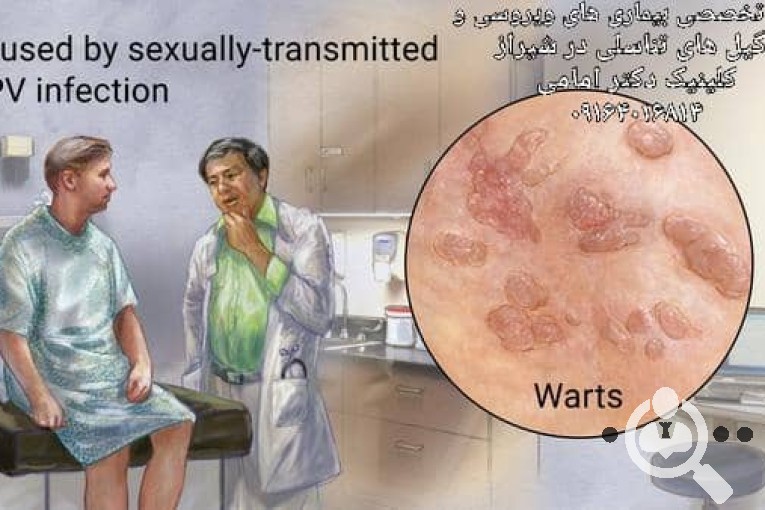 کلینیک زیبایی و درمان قطعی زگیل تناسلی دکتر امامی در شیراز