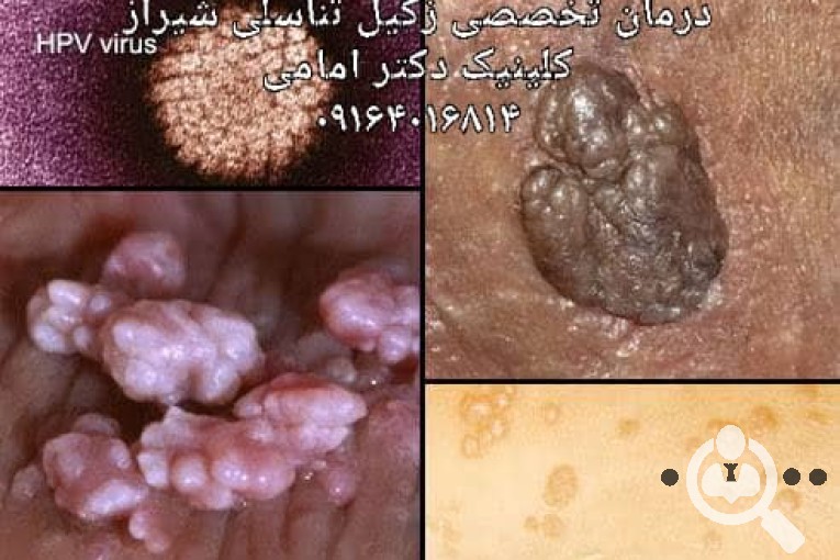 کلینیک زیبایی و درمان قطعی زگیل تناسلی دکتر امامی در شیراز