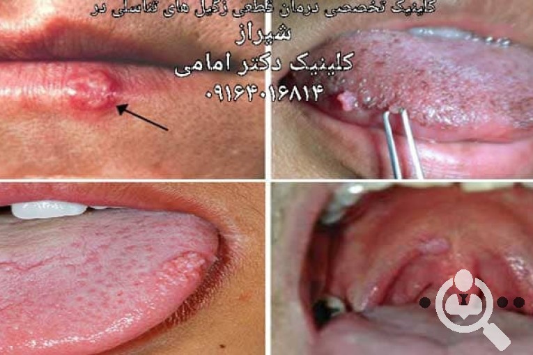 کلینیک زیبایی و درمان قطعی زگیل تناسلی دکتر امامی در شیراز