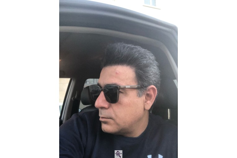کاشت ابرو زینب حقیقت در شیراز