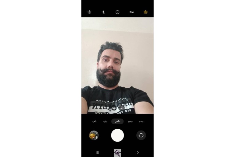 کاشت ابرو زینب حقیقت در شیراز