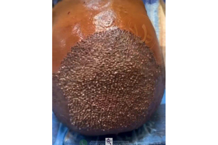 بهترین و پرتراکم ترین کاشت مو و ابرو در اهواز 09129673677