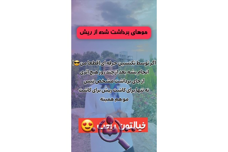 کاشت مو افروز روغنکران در شیراز