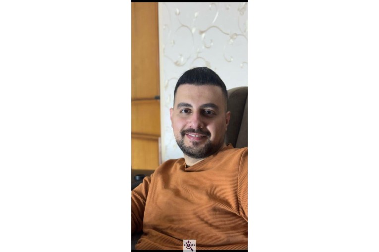 کاشت مو شیخی تبریز