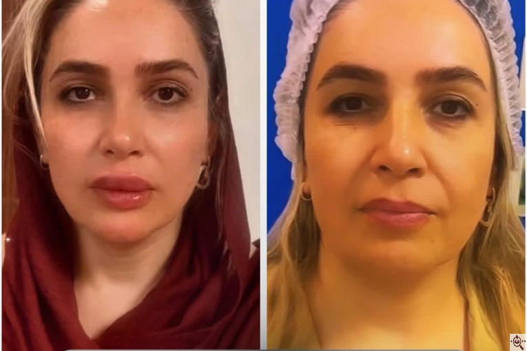 مرکز پوست و زیبایی تالگو آسانا در فرشته تهران 