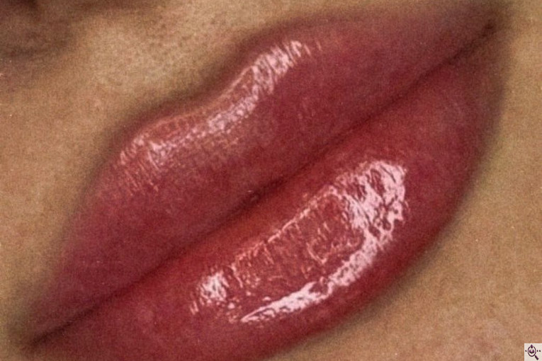 مرکز پوست و زیبایی تالگو آسانا در فرشته تهران 