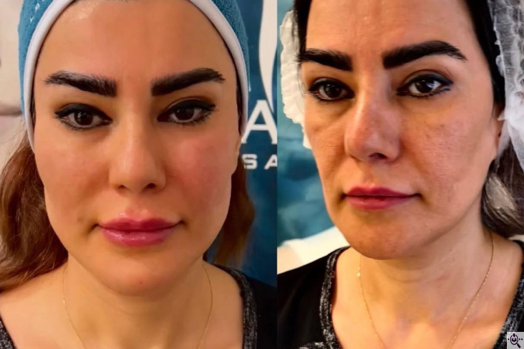 مرکز پوست و زیبایی تالگو آسانا در فرشته تهران 