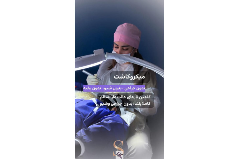 کاشت مو سامره حاجی پور در اهواز