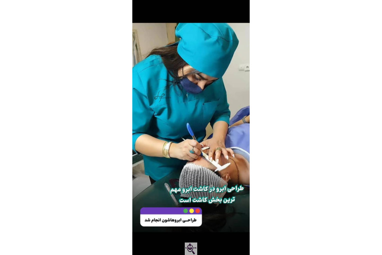 کاشت مو حیدری زاده در اهواز
