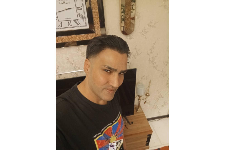 کاشت مو گلزادی در شیراز