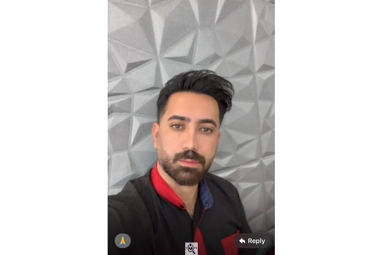 کاشت مو گلزادی در شیراز