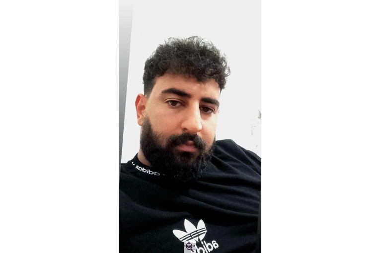 کاشت مو گلزادی در شیراز