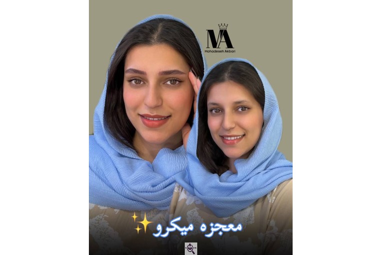 خدمات تخصصی فیبروز میکروبلیدینگ محدثه اکبری در قزوین