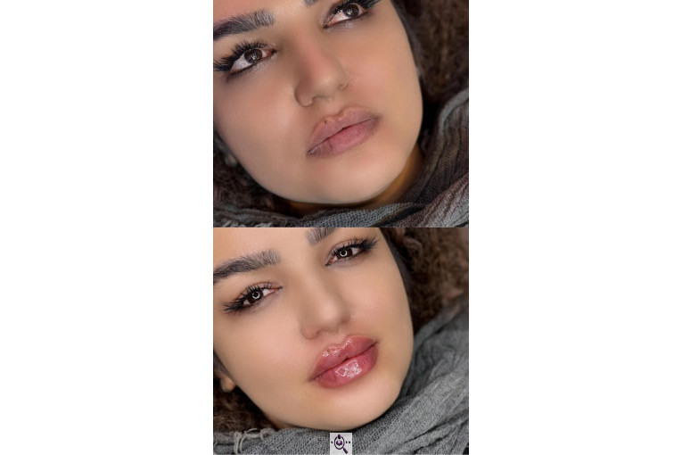 کلینیک زیبایی شقایق در تهران