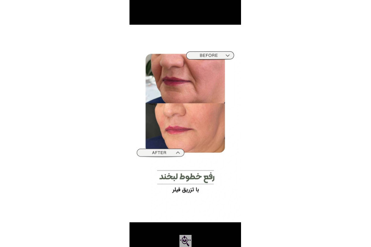 کلینیک زیبایی شقایق در تهران