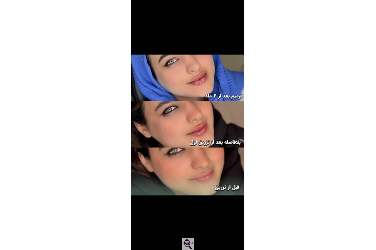 کلینیک زیبایی شقایق در تهران