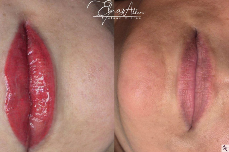 میکروبلیدینگ الناز اکبری در اندیشه کرج