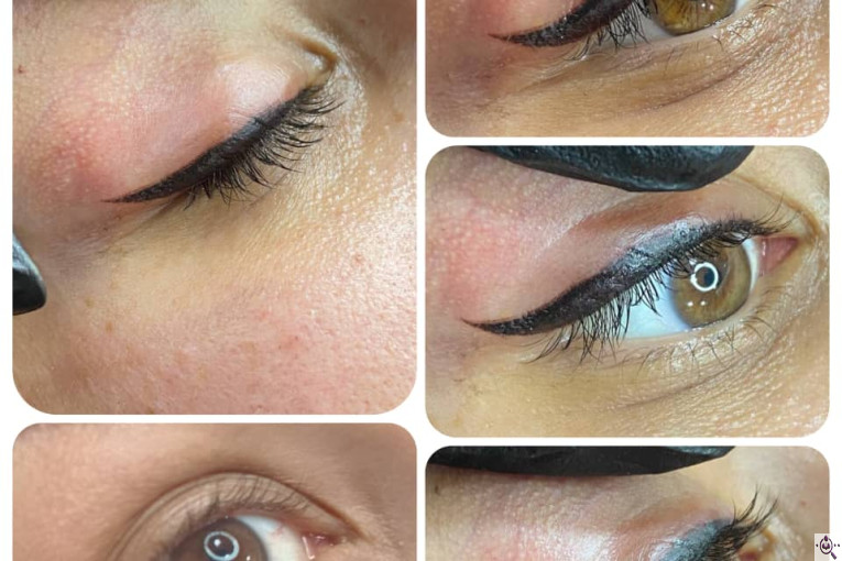 میکروبلیدینگ الناز اکبری در اندیشه کرج