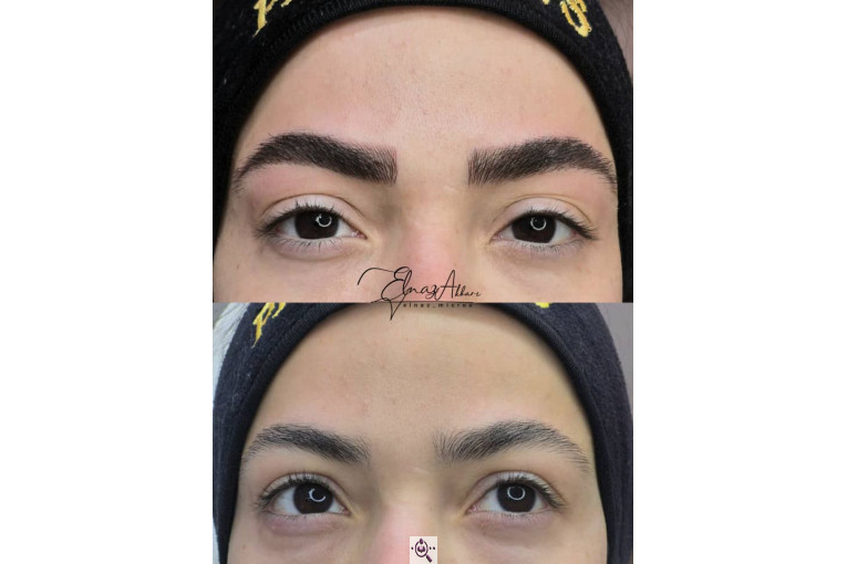 میکروبلیدینگ الناز اکبری در اندیشه کرج