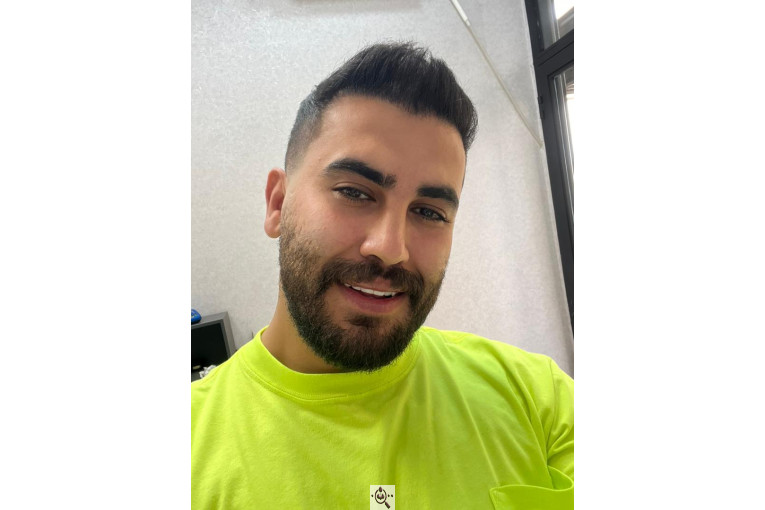 کاشت مو فرزانه رزمی در تهران