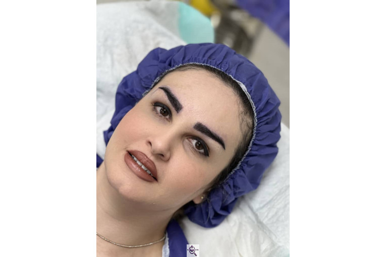 کاشت مو فرزانه رزمی در تهران