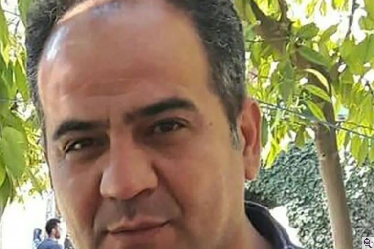 کاشت مو فرزانه رزمی در تهران