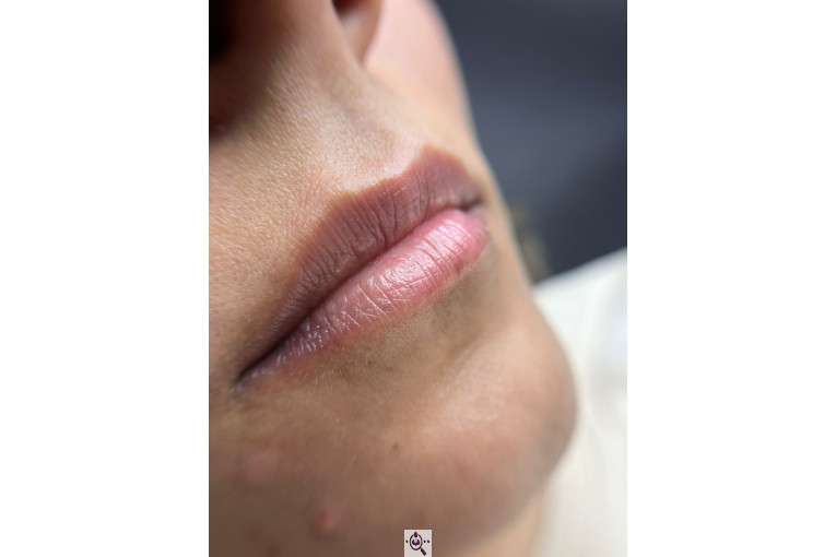 میکروبلیدینگ حانیه طایفی در یزد