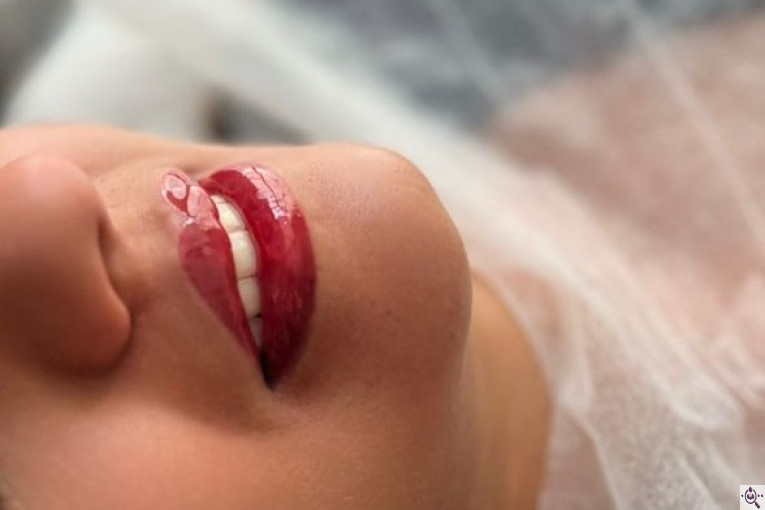 میکروبلیدینگ حانیه طایفی در یزد