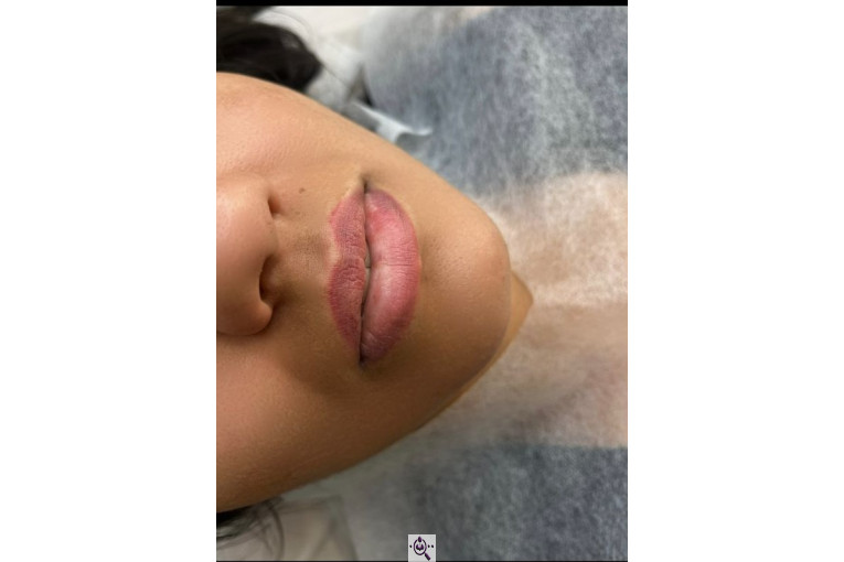 میکروبلیدینگ حانیه طایفی در یزد