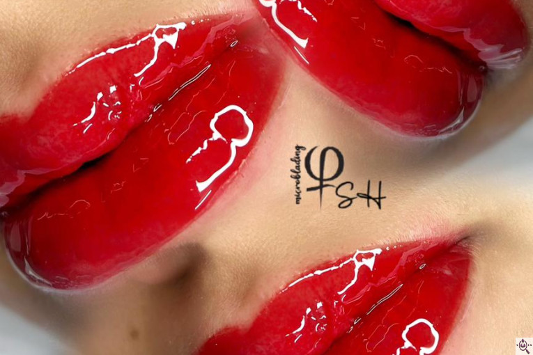 میکروبلیدینگ شاهدادی در کرمان