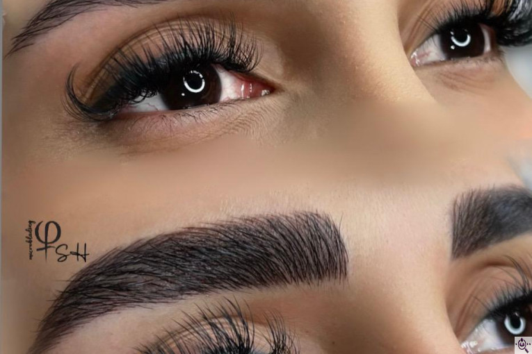 میکروبلیدینگ شاهدادی در کرمان