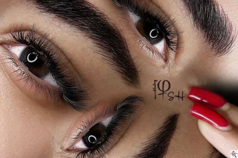 میکروبلیدینگ شاهدادی در کرمان