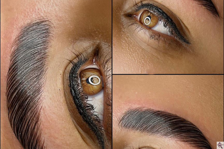 میکروبلیدینگ شاهدادی در کرمان