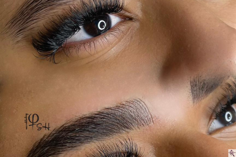 میکروبلیدینگ شاهدادی در کرمان