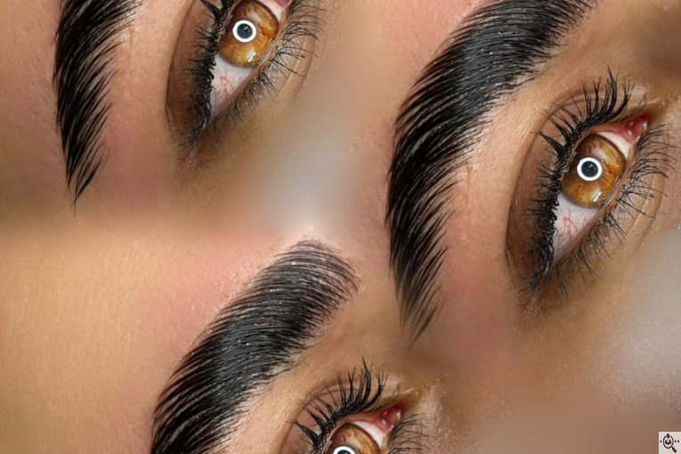 میکروبلیدینگ شاهدادی در کرمان