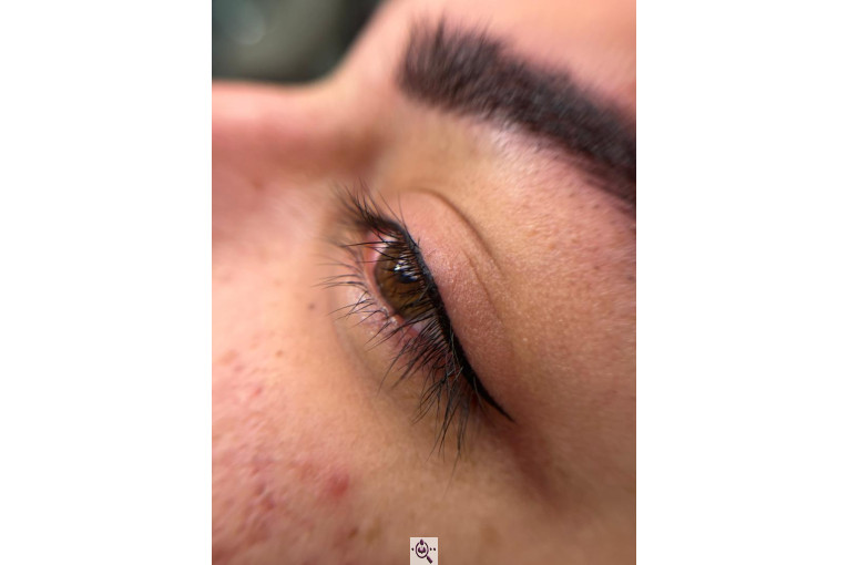 میکروبلیدینگ لیدا ابوالفضلی در یزد