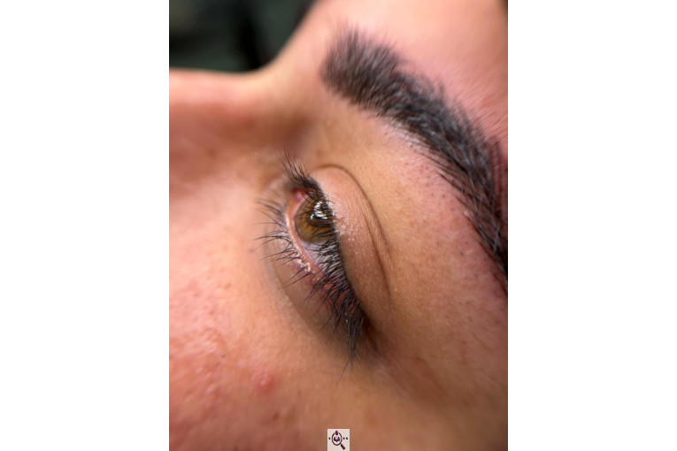 میکروبلیدینگ لیدا ابوالفضلی در یزد