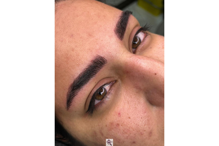 میکروبلیدینگ لیدا ابوالفضلی در یزد