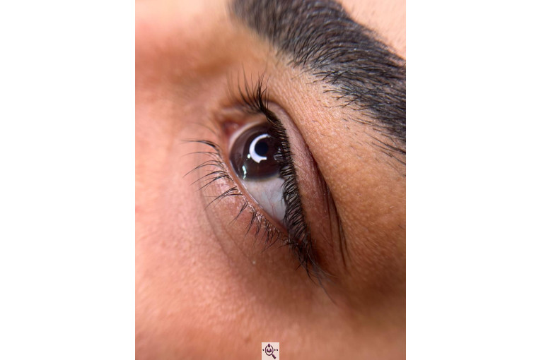 میکروبلیدینگ لیدا ابوالفضلی در یزد