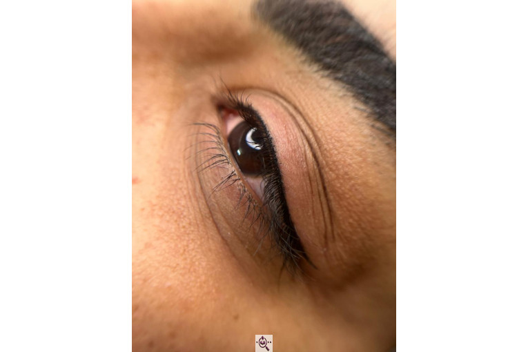 میکروبلیدینگ لیدا ابوالفضلی در یزد