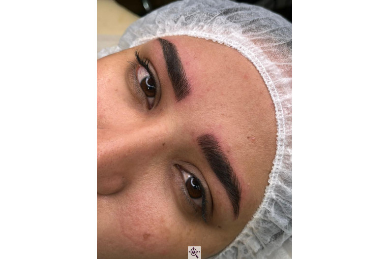 میکروبلیدینگ لیدا ابوالفضلی در یزد