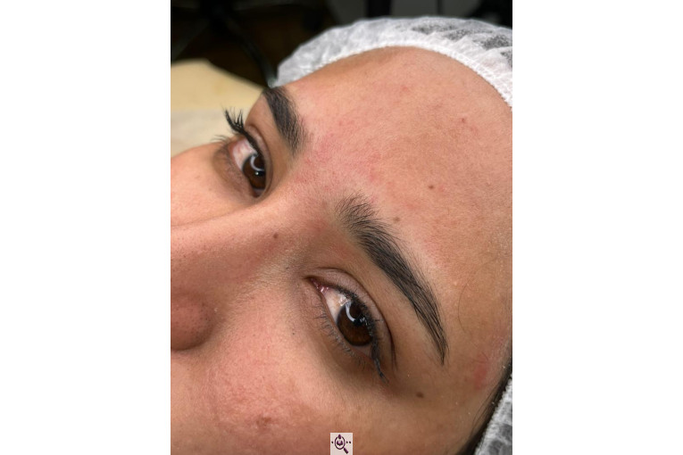 میکروبلیدینگ لیدا ابوالفضلی در یزد