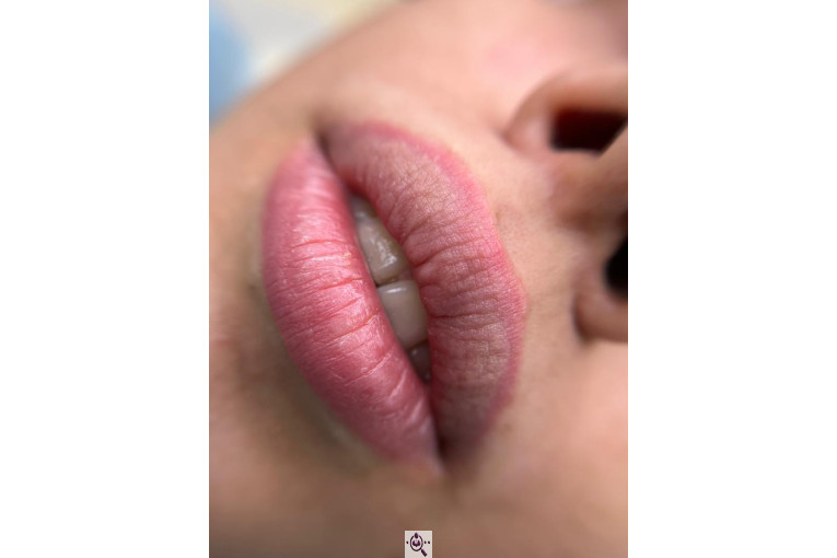 میکروبلیدینگ لیدا ابوالفضلی در یزد