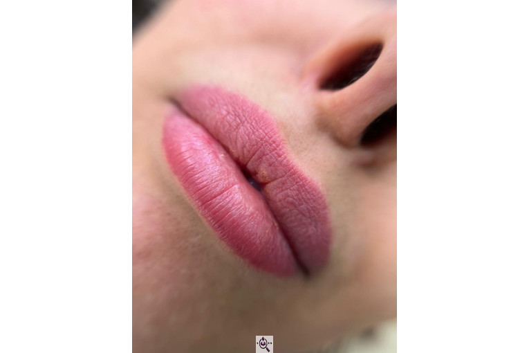 میکروبلیدینگ لیدا ابوالفضلی در یزد