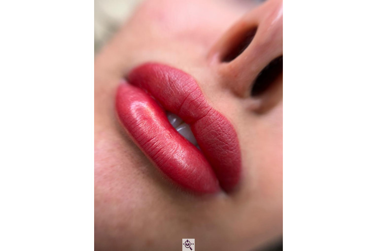 میکروبلیدینگ لیدا ابوالفضلی در یزد