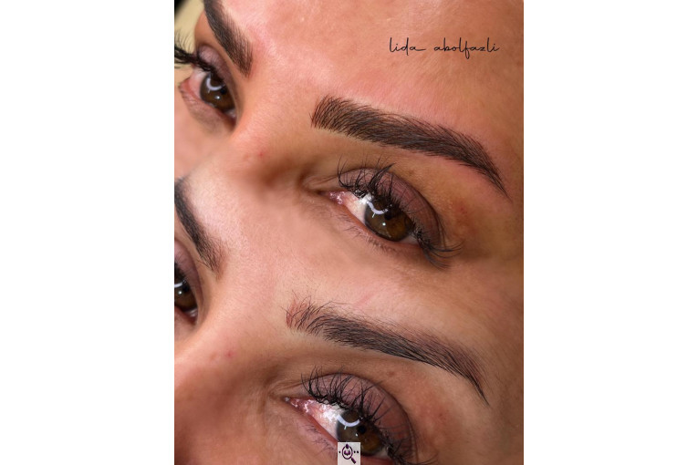 میکروبلیدینگ لیدا ابوالفضلی در یزد